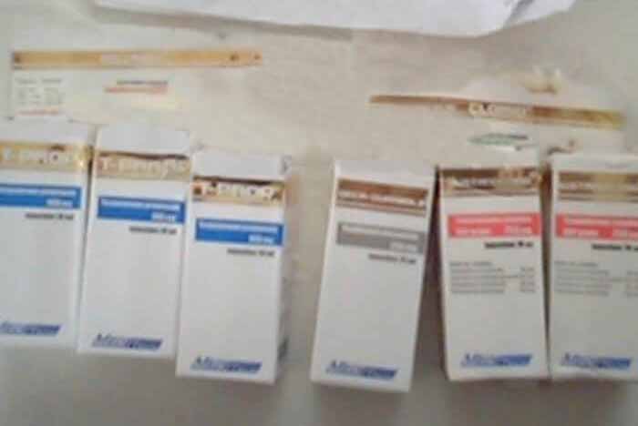 15 فبراير 2018، فرساي، فرنسا